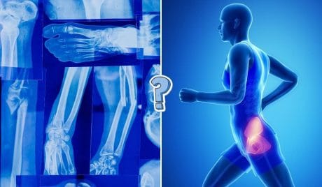 QUIZ: Anatomy true or false questions